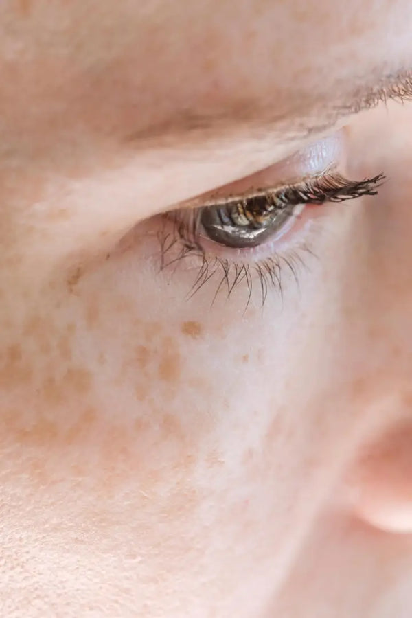 Inflammaging: The Silent Driver of Premature Skin Aging